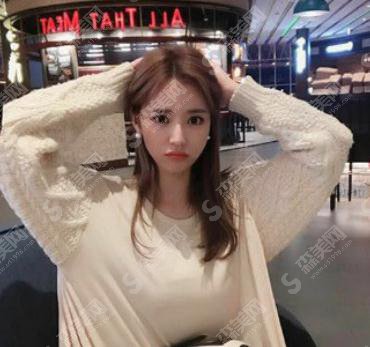 南宁熠美整形价目表2021，内含面部吸脂果图对比