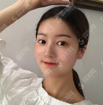 成都军大整形美容医院价目表2021,内含下颌角整形案例果图