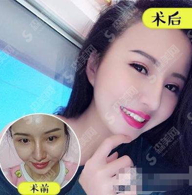 湘雅附三整形科靠谱吗？医院概述/医生简介/案例展示