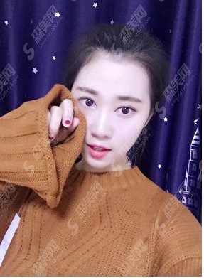 北京八大处做的双眼皮怎么样?附医院简介/案例分享/注意事项