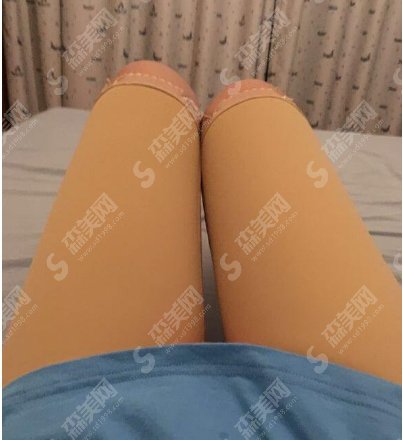 成都铜雀台吸脂哪个好?附医院简介/大腿吸脂案例分享