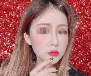 南通维多利亚价目表2021，内含注射瘦脸案例果图对比