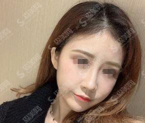 南通维多利亚价目表2021，内含注射瘦脸案例果图对比