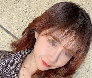 南通维多利亚价目表2021，内含注射瘦脸案例果图对比