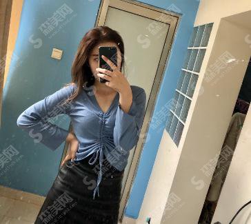 秦皇岛巧致整形价格表2021,内含腰腹吸脂术后的恢复情况