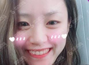 康贝佳口腔医院价格表2021，内含隐形矫正果图公布