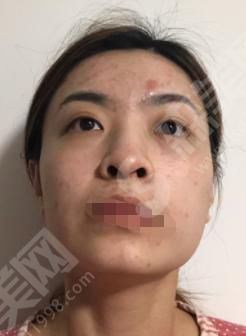 宜春的整形医院有哪几个？宜昌韩美医院怎么样？附医师简介及案例分享