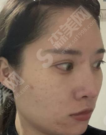 桂林华美医院怎么样?桂林整形医院祛斑怎么样?附医师介绍及案例分享