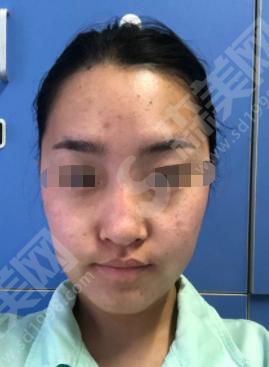 美莱和华美哪个好?做的隆鼻怎么样？附医院介绍及医师介绍