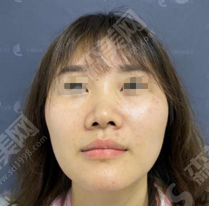 浙江大学医学院附属妇产科医院怎么样？附医师介绍及隆鼻案例分享