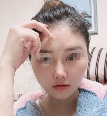 浙江大学医学院附属妇产科医院怎么样？附医师介绍及隆鼻案例分享