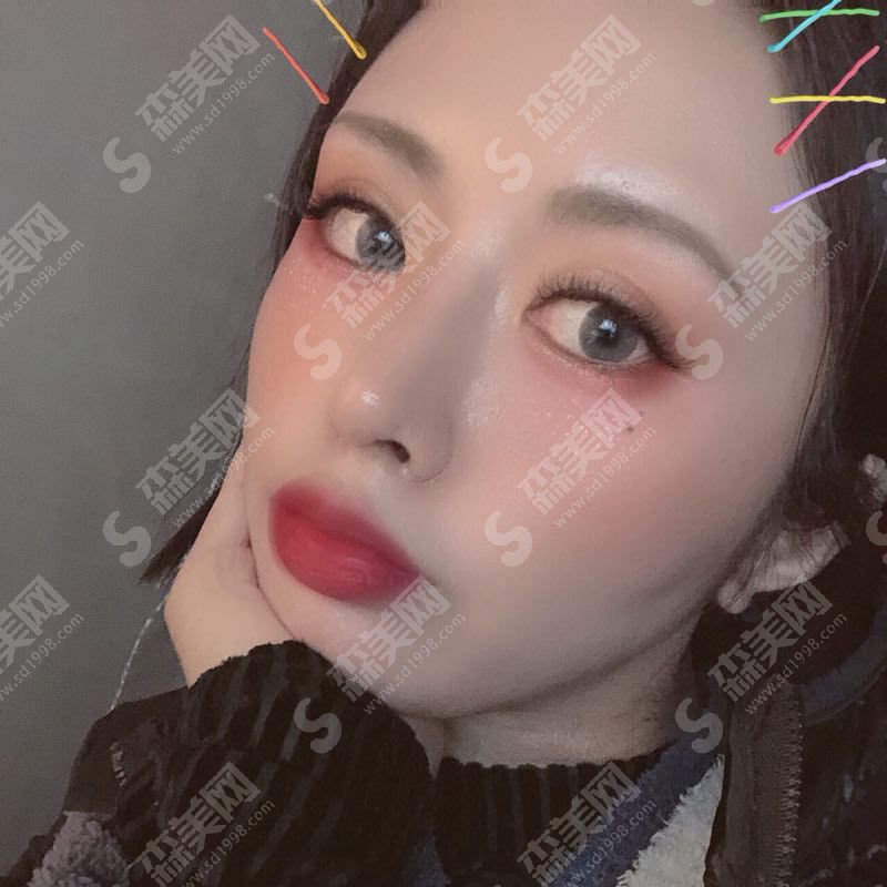 西京医院隆鼻医生那个好?技术口碑怎么样?内附隆鼻整形的案例果图