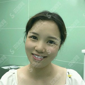 西安西京华京医院的整形价目表2020,华京医院的双眼皮手术怎么样?内附双眼皮手术的恢复案例图