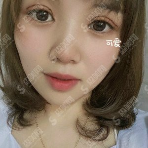 西安西京华京医院的整形价目表2020,华京医院的双眼皮手术怎么样?内附双眼皮手术的恢复案例图