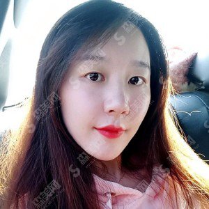 西安西京医院怎么样？西安西京医院介绍/面部填充的方案设计/面部填充的术后果