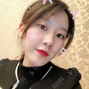 西安西京医院怎么样？西安西京医院介绍/面部填充的方案设计/面部填充的术后果