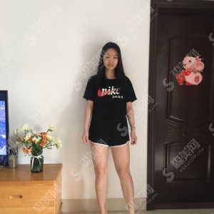 第四军医大学西京医院的吸脂价目表2020,大腿吸脂怎么样?内附大腿吸脂的过程恢复对比图