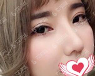 芜湖伊莱美整形医院靠谱吗?医院概述/医生信息/案例分享