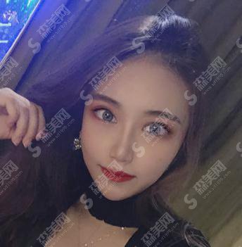 成都铜雀台整形医院价格表2021,附隆鼻的全恢复照片