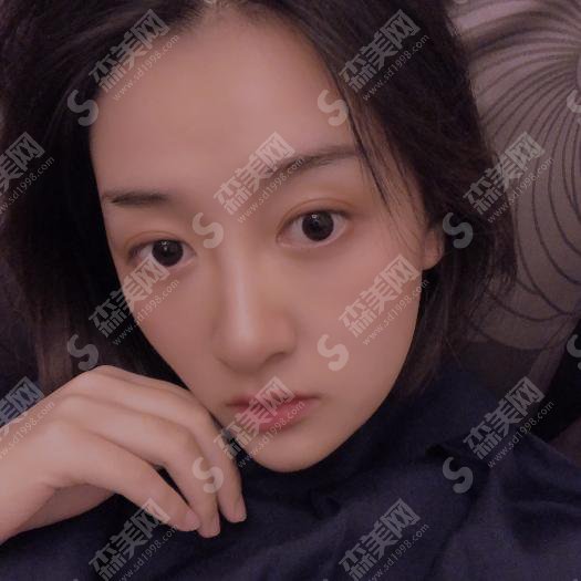 南宁西京医院激光祛斑的整形价目表2020,激光祛斑的治疗怎么样？内附激光祛斑的整形修复案例对比