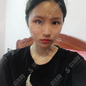 西京医院皮肤科怎么样？花费如何？西京医院皮肤科介绍/西京医院的医生介绍/激光祛斑的果