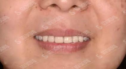 深圳正夫口腔门诊部值得信赖吗?医院概述/案例展示