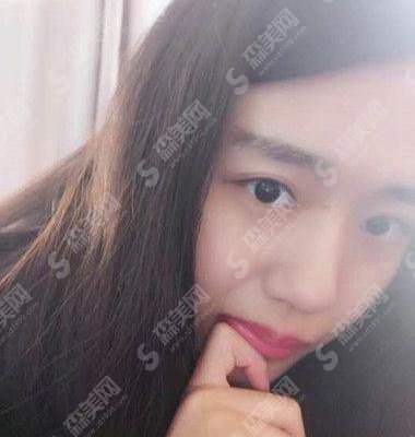 丁建宇医生矫正牙齿专业吗?长沙中诺口腔医院/口碑如何/案例展示