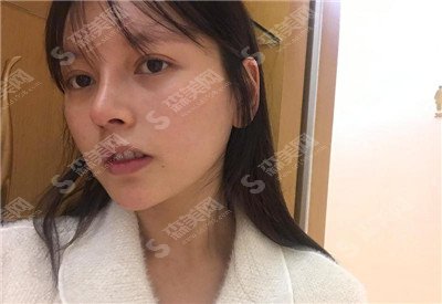 福州三甲医院怎么样?福州省立医院概况/医生实力介绍/光子嫩肤治疗果