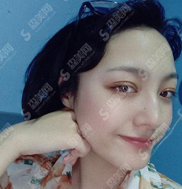 武汉天后整形医院价目表2021，内含割双眼皮的全部过程图