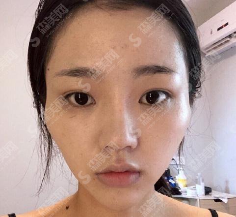 整形医生穆雄铮面部轮廓整形做的可以吗?华山医院/口碑了解/案例展示