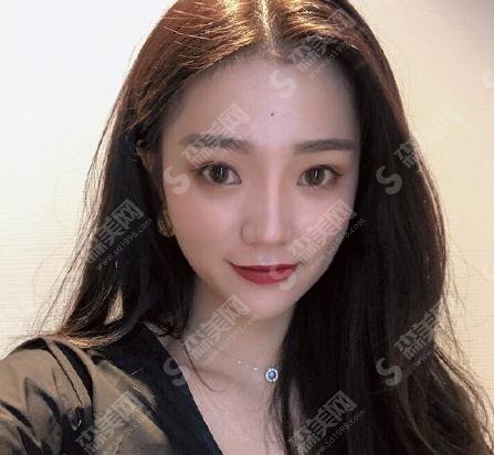 整形医生穆雄铮面部轮廓整形做的可以吗?华山医院/口碑了解/案例展示