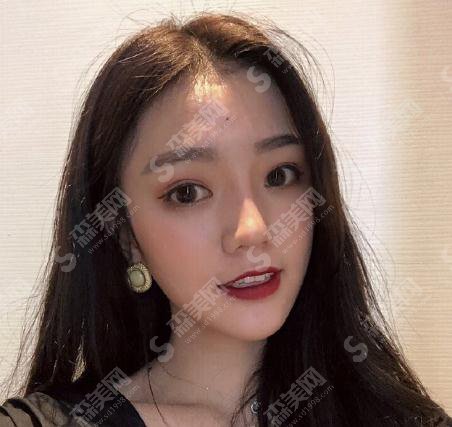 整形医生穆雄铮面部轮廓整形做的可以吗?华山医院/口碑了解/案例展示