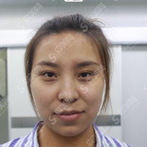 深圳美一度整形医院怎么样?医院的实力介绍/医生介绍/面部吸脂的果