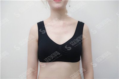 郑州美莱和集美哪个好?医院的介绍/集美整形的隆胸过程/隆胸以后的果