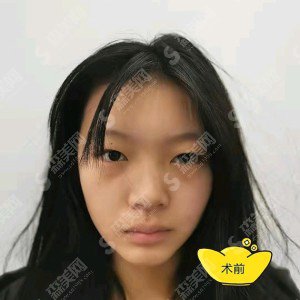 韩新鸣医生怎么样?医生实力盘点+双眼皮手术的案例分享