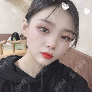 韩新鸣医生怎么样?医生实力盘点+双眼皮手术的案例分享