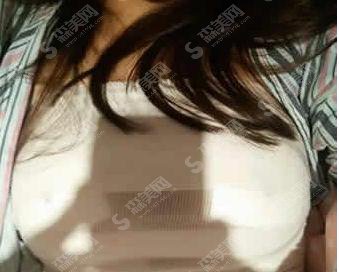 贾文整形医生隆胸做的技术怎么样?大同美神整形医院/口碑情况/案例展示