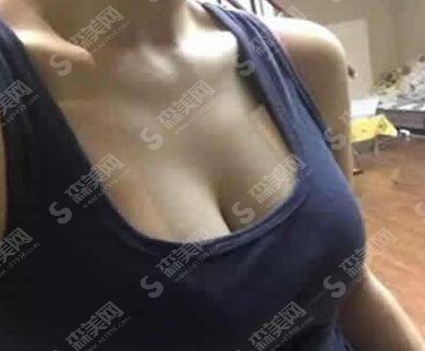 贾文整形医生隆胸做的技术怎么样?大同美神整形医院/口碑情况/案例展示