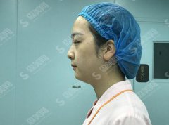 福州台江医院整形美容科价目表2021，内含眼部手术案例果对比图
