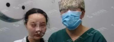 李清法整形医生隆鼻技术好吗?西安艺星整形/口碑情况/隆鼻案例