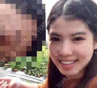 上海九院牙齿贴面价格2021,内含牙齿贴面果图公布