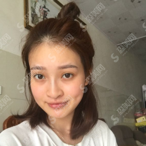 上海九院怎么样？上海九院概况/医生/瓜子脸整形手术的操作果