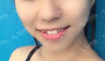 石家庄中诺口腔医院怎么样？石家庄中诺口腔的实力/石家庄中诺口腔的医生/牙齿矫正的整形果