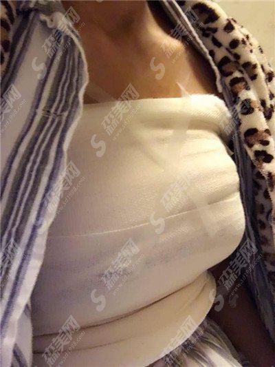 成都整形医院排名的机构有哪些?公立整形机构/私立整形机构/成都西区隆胸案例