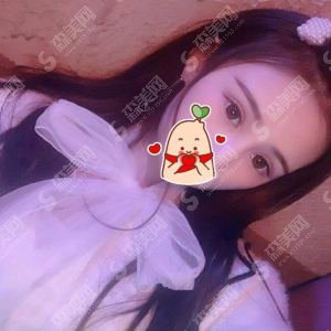 欧洲之星fotona整形价目表,欧洲之星fotona怎么样?内附欧洲之星的治疗案例果