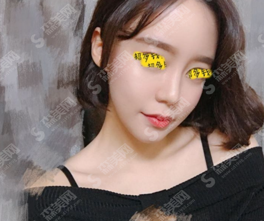 沈阳杏林整形美容医院做的膨体隆鼻果怎么样?附医生介绍/案例分享/2021较新价目表