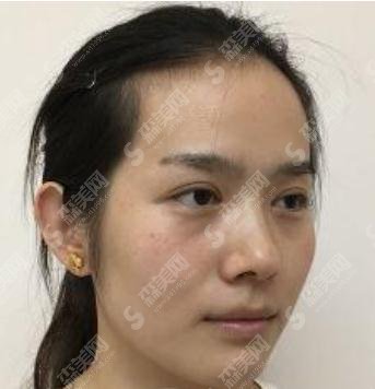 九院美白价格,2021价目表公布,内含美白案例