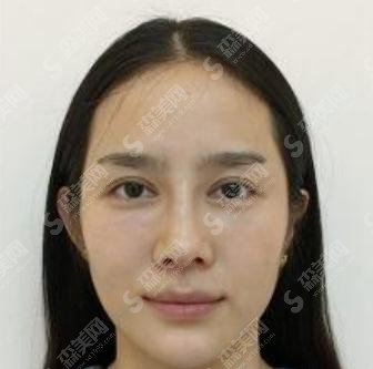 九院美白价格,2021价目表公布,内含美白案例