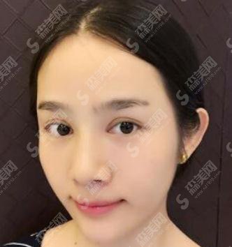 九院美白价格,2021价目表公布,内含美白案例