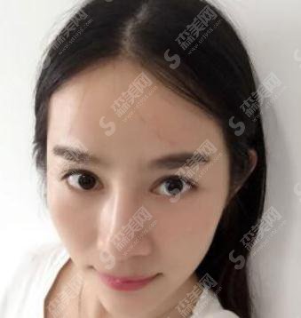 九院美白价格,2021价目表公布,内含美白案例